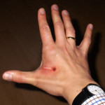 666-chip-implant-600-300x291